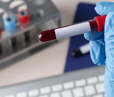 Blood transfusion for low immunity patients